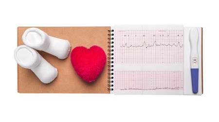 Electrocardiography, close-up. Notebook pregnant. The result of consulting a doctor.の写真素材