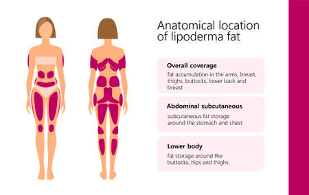 anatomical location of lipoderma fat in woman body, vector illustrationのイラスト素材