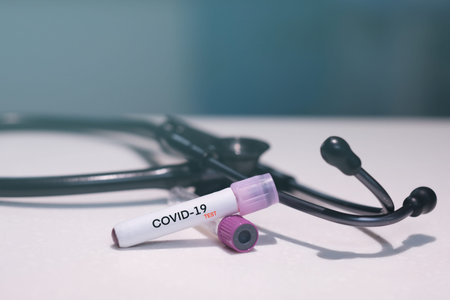 COVID-19 laboratory blood test coronavirus background concept