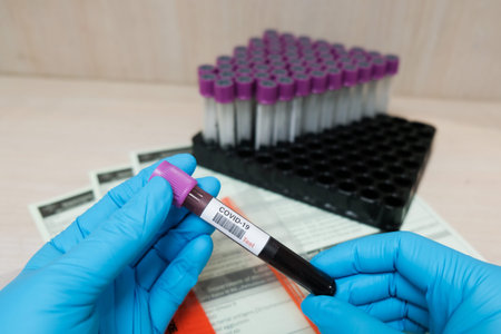 Covid-19 blood test in hospital laboratory
