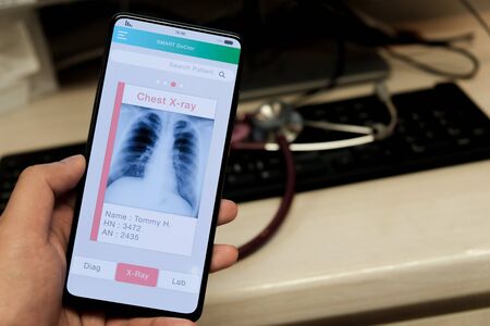 A doctor view chest X-ray on smartphone application の写真素材