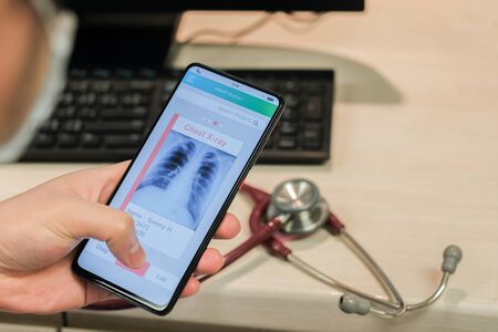 A doctor view chest X-ray on smartphone application の写真素材