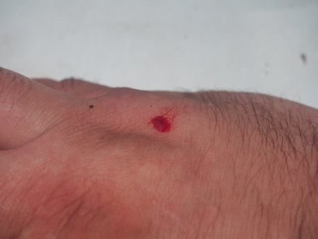 A drop of blood on the skin of a person's hand. The person received a minor injury. Close up