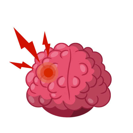 Headache. Red spot in human brain. Pain with red lightning. Problem with head. Medical care. Cartoon flat illustrationのイラスト素材