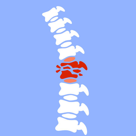 X-ray of internal organs. Medical care. Fracture of intervertebral discs. Crack in the White bone....