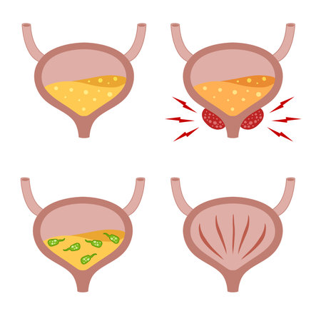Bladder with urine. internal organ of the people. Set of medical illustration isolated on white...