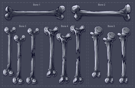Detailed graphic realistic black and white different isolated broken human bones. On gray background. Vector icon set.のイラスト素材