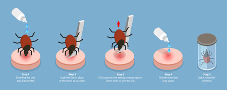 3D Isometric Flat Vector Conceptual Illustration of How To Remove a Tick, A Parasite Carrying a Diseaseのイラスト素材