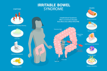 3D Isometric Flat Vector Conceptual Illustration of Irritable Bowel Syndrome, Stomach Problemのイラスト素材