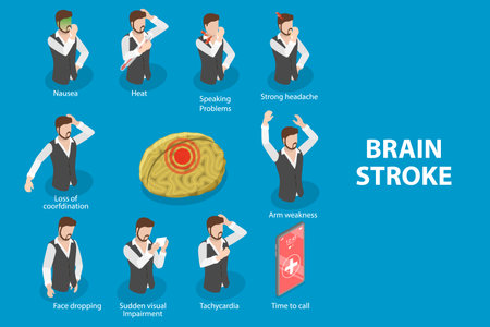 3D Isometric Flat Vector Illustration of Brain Stroke Symptoms, Medical Recognizing Diagramのイラスト素材