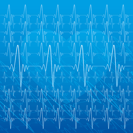 Medical illustration of heartbeat.のイラスト素材