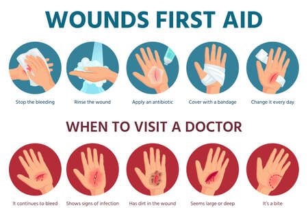 First aid for wound on skin. Treatment procedure for bleeding cut. Bandage on injured palm. Emergency situation safety infographic in vector. Illustration aid skin, injury and traumaのイラスト素材