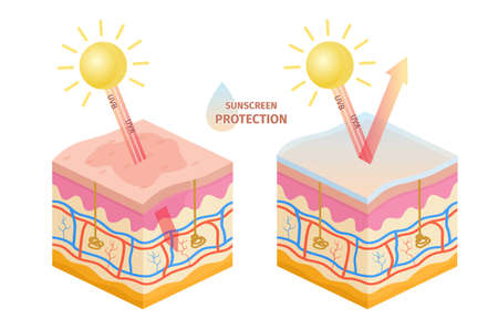Human skin uv rays protection, before and after sunscreen. Sun uva, uvb epidermis damage prevention lotion. Skin sunburn vector infographicのイラスト素材