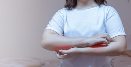 woman scratching arm from having itching allergic reaction to insect bites, dermatitis, food, drugs....