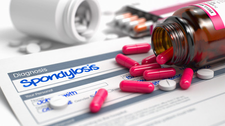 Spondylosis - Handwritten Diagnosis in the Anamnesis. Medical Concept with Heap of Pills, CloseUp View, Selective Focus. Spondylosis Phrase in Anamnesis. CloseUp View of Medical Concept. 3D.の写真素材