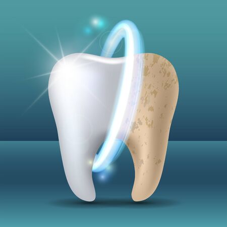 Clean and dirty tooth before and after whiteningのイラスト素材