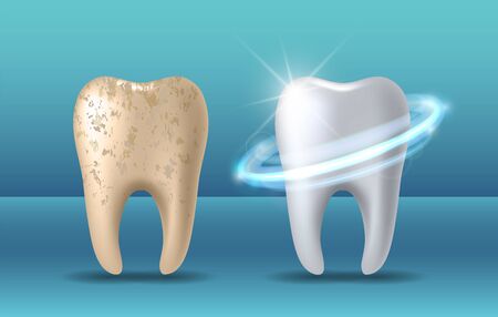 Teeth whitening 3d concept. Comparison of clean and dirty tooth before and after whitening treatment. Teeth whitening procedure, dental health and oral hygiene poster for dentistry designのイラスト素材