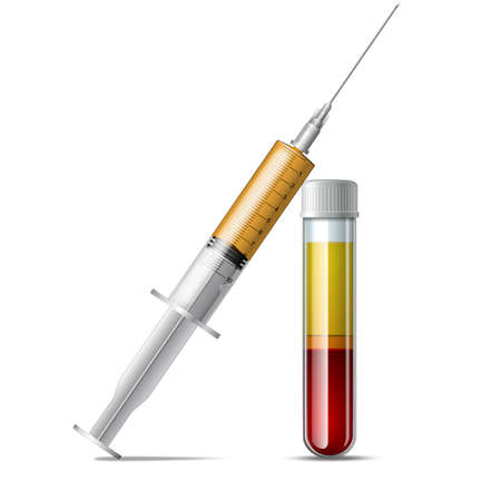 PRP therapy for knee disease, alopecia and facelift. Separation of erythrocytesのイラスト素材