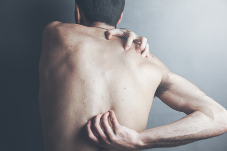 back view of young shirtless man with neck pain