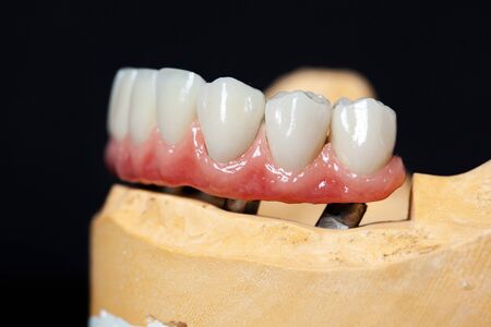high-quality prosthesis on the dark background