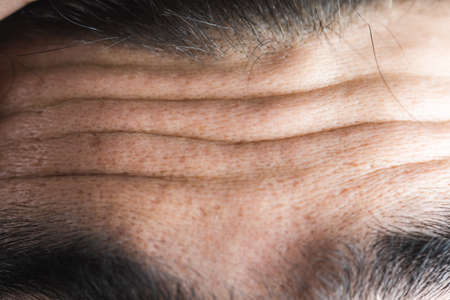 the young man forehead wrinklesの写真素材