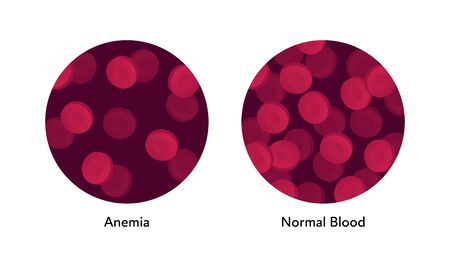 Vector flat blood cell illustration. Red gradient erythrocytes in set of circle frames isolated on white background. Concept of anemia. Design element for poster, flyer, card, banner, ui, presentationのイラスト素材