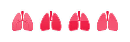 Human organ collection. Vector flat modern anatomical icon color illustration set. Healthy and ill red lung isolated on white background. Health care medical sign. Design element for pulmonology.のイラスト素材