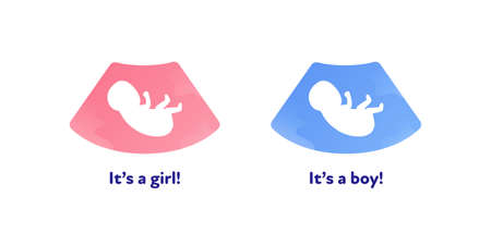 Ultrasound pregnancy diagnostic concept. Vector flat illustration. Ultrasonographer device with ultrasound and baby in womb symbol. It's girl, boy text. Design for health care, ultrasonographyのイラスト素材