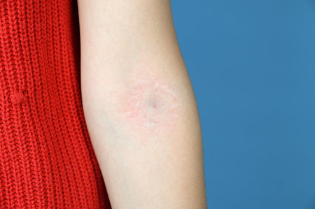 A woman's hand with a patch mark and a bruise after an injection or blood donation, blue background...