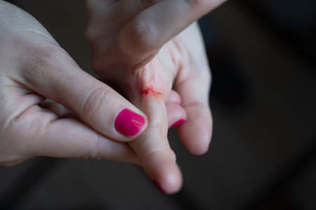 Close-up of a finger of a human hand cut painfully, bleeding bright red blood. High quality photoの写真素材