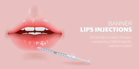 Lip filler injection banner. Female lips and syringe. Vector illustrationのイラスト素材