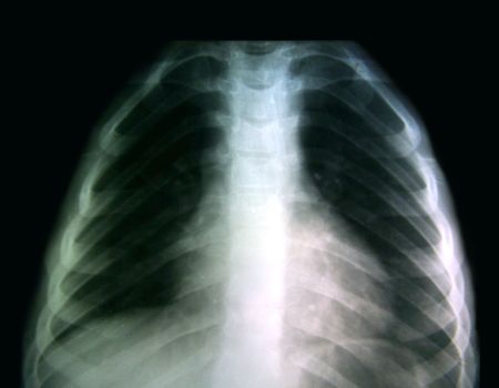 Medicine and health.の写真素材