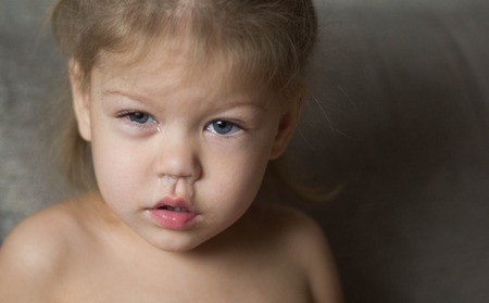 child has a runny nose with cの写真素材