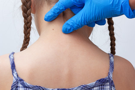 Adult fingers in glove showing birthmark on child neck back on white background