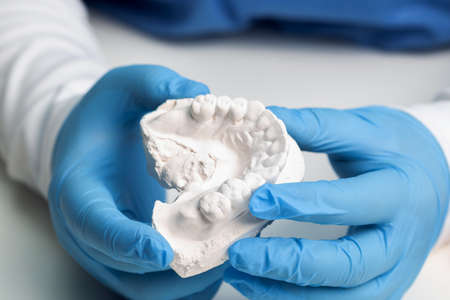 a dentist holds a cast of teeth in his hands in medical gloves for making invisible braces for...