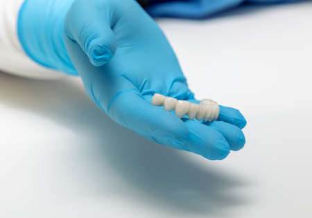 white ceramic bridge made of dental crowns in the hand of a dentist, dental technician, close-upの写真素材