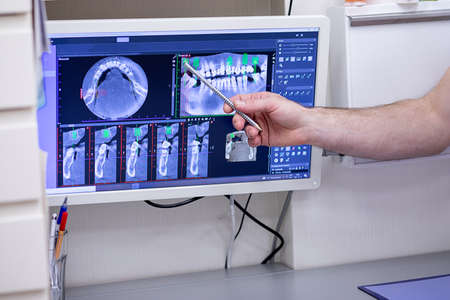 Dentist doctor point at x-ray footage of teeth online displayed on desktop monitor with stylus to...