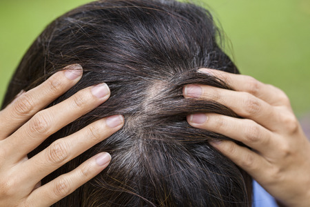 Young woman shows her gray hair rootsの写真素材