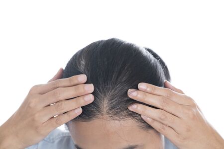 Young woman shows her gray hair rootsの写真素材