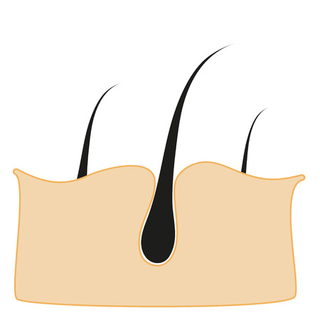 poreのイラスト素材