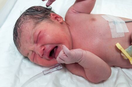 Newborn in hospital, just arrive in nursery room.