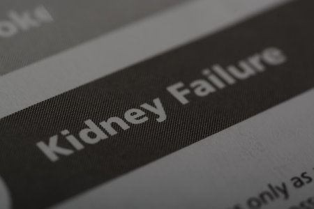 Close up view of the word KIDNEY FAILURE. Kidney failure, also known as renal failure, is a serious medical condition where the kidneys are unable to function effectivelyの写真素材