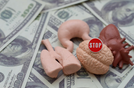 Stop Illegal Organ Trafficking: Conceptual image of a stop sign on human organs and money,...