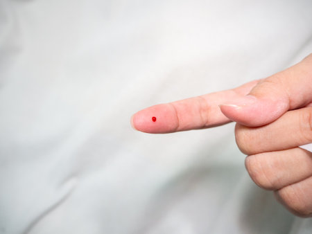 Diabetes test. Healthcare and medical concept, The diabetic measures the level of glucose in the blood.の写真素材