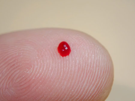 blood drop on fingertip from glucose test .The diabetic measures the level of glucoseの写真素材
