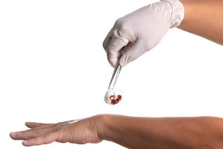 Doctor hand in white latex sterile gloves with forceps isolated on white backgroundの写真素材