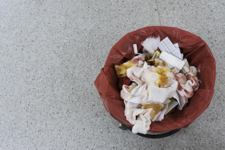 Dirty garbage after surgery in the operating roomの写真素材