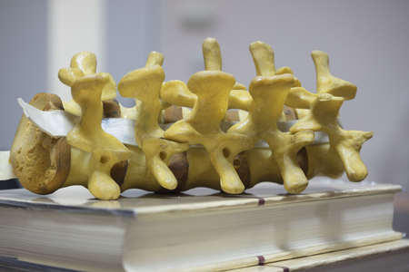 Lumbar spine model on medical textbook in doctor office