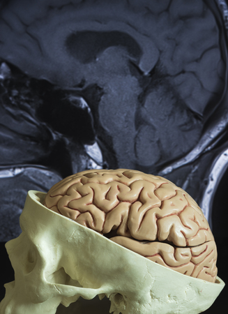 Human artificial brain model with side view of brain MRI picture backgroundの写真素材