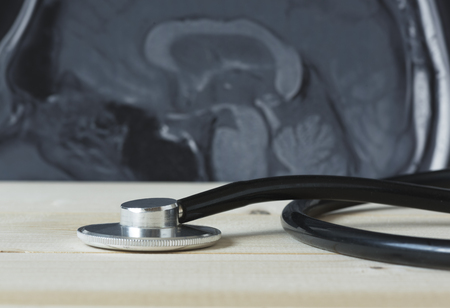 A black stethoscope and human brain MRI on wooden table